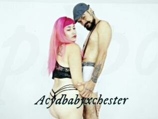Acydbabyxchester