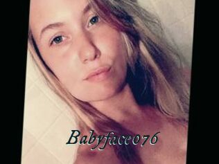 Babyface076